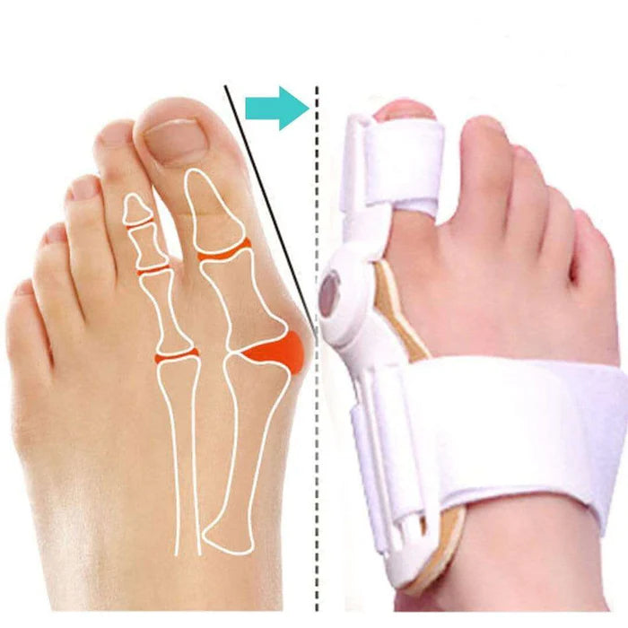 Corrector Confort para Juanete – Simplicidad y Bienestar