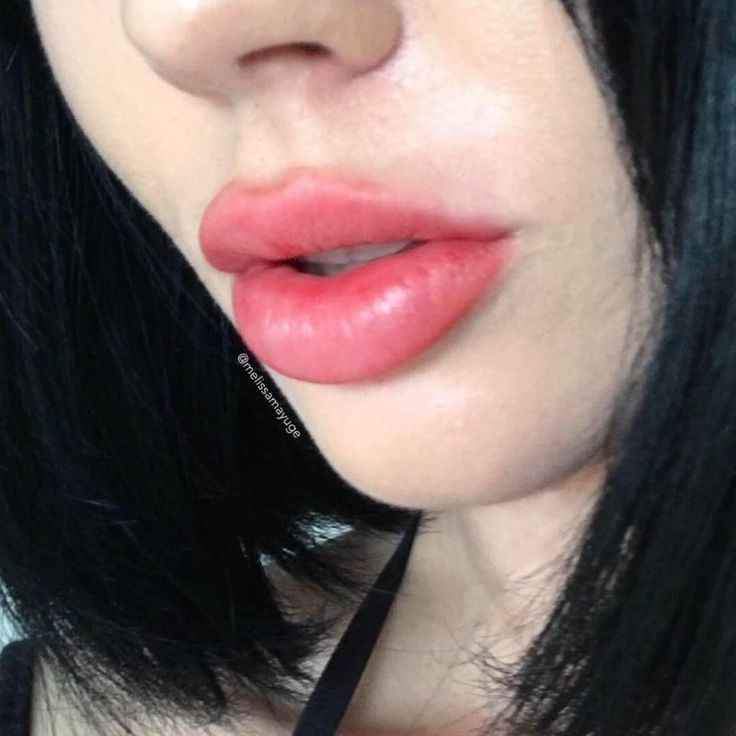 VOLUMINIZADOR DE LABIOS