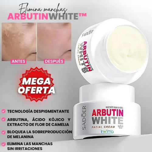 💡 Crema Aclarante Arbutin – ✨ ENVÍO GRATIS 🌸